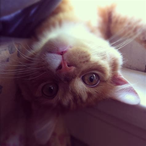 Lower Lip Freckle