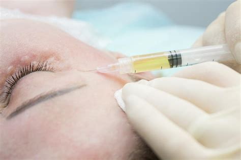 Wonderful PRP - Platelet Rich Plasma - Revive Clinic
