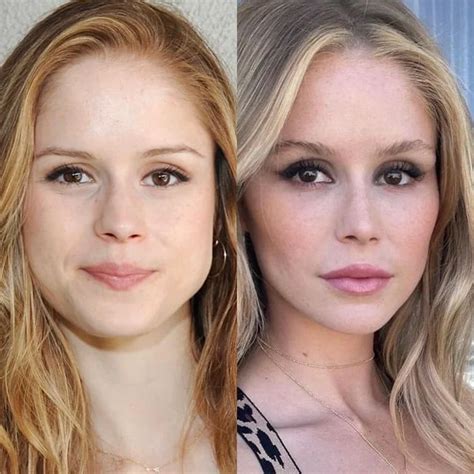 Erin Moriarty Plastic Surgery: Debunking the Rumors