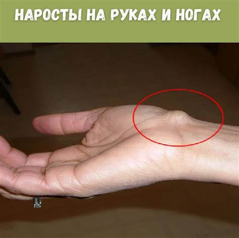 Шишка на руке - фото и картинки: 66 штук