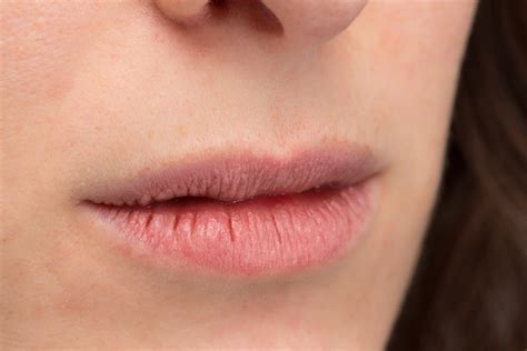 Labios Muito Ressecada O Que Pode Ser - Boca ressecada: 5 Dicas para evitar e acabar com esse problema