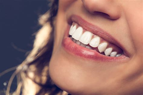 Sorriso Versiculo - Como ter um sorriso perfeito? Veja 7 dicas para arrasar! - Odontocompany