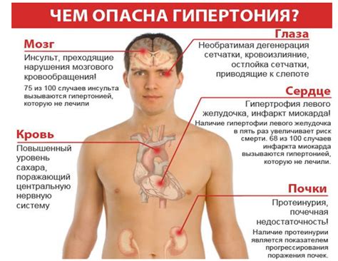 Что нужно знать о гипертонии