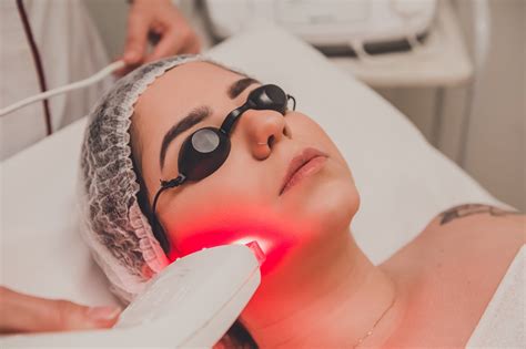 Luz Pulsada Para O Rosto - Luz Intensa Pulsada (LIP) - Dr. Charles Esteves