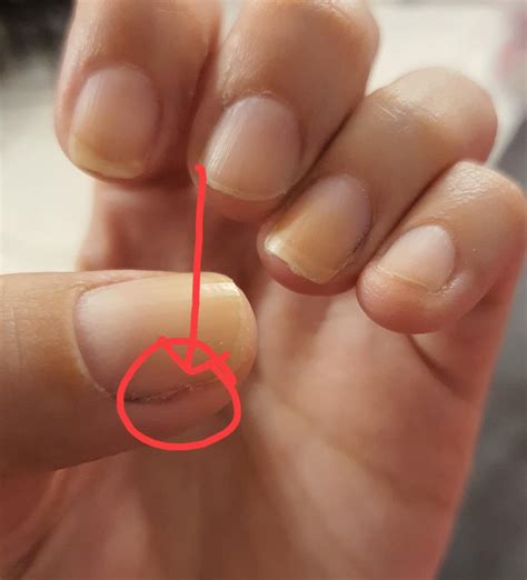 Mi thumb nails always break at the same spot. Right in the middle of