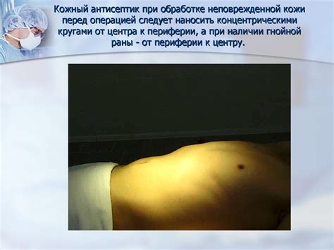 Современные способы обработки рук хирурга и операционного поля ...