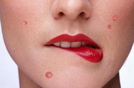 Простудные прыщи на лице: лечение, симптомы и профилактика - Уход за лицом