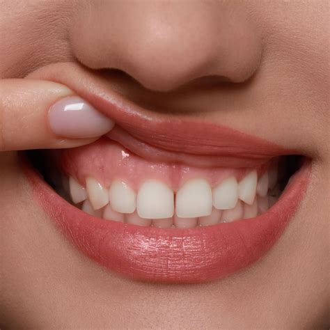 Encías sanas: consejos para identificarlas y mantenerlas con salud