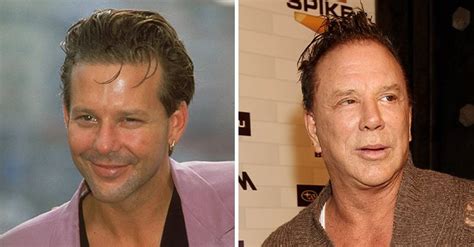 Mickey Rourke Looks Unrecognizable after Plastic Surgery – A Glimpse ...