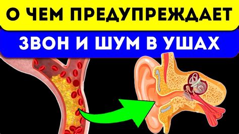 3 капли за ужином и прошел звон в ушах и голове - YouTube
