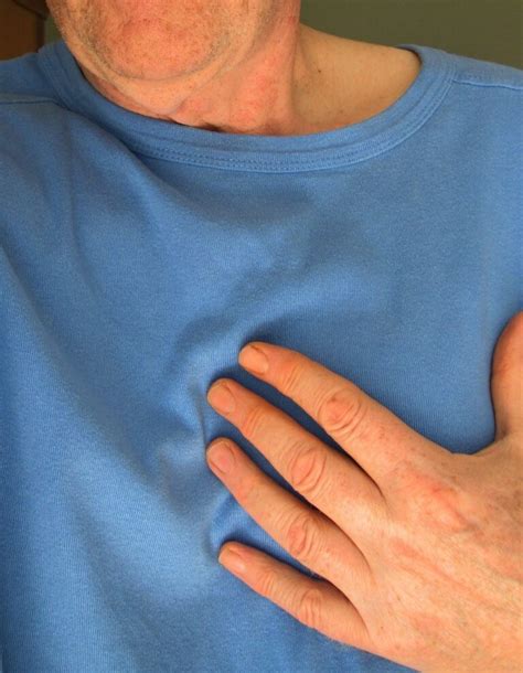 Myotonic Dystrophy