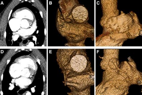 computed tomography ct ct images      month