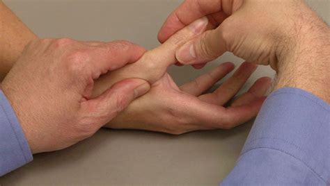 sprained thumb orthoinfo aaos