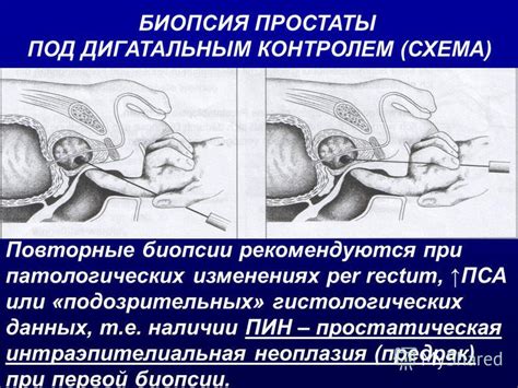 Презентация на тему: "Рак предстательной железы к.м.н., доцент клиники ...