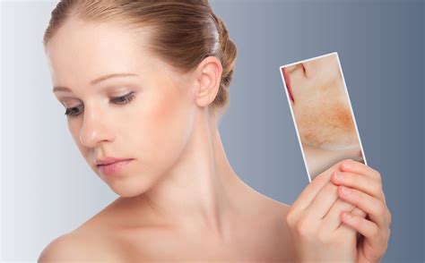 transform    goodbye  burn scars  face