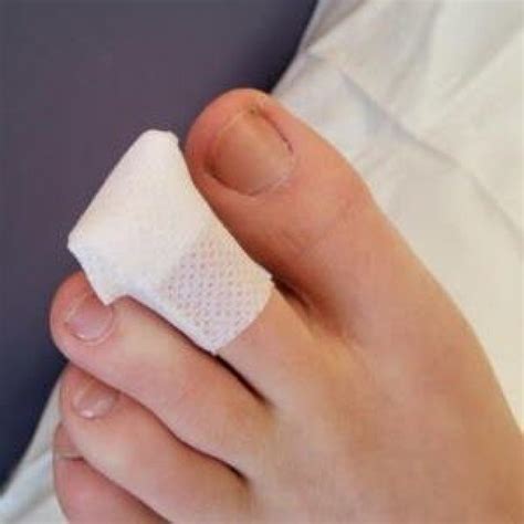 How To Bandage A Toe Wound With A Self-adhesive Dressing – First Aid