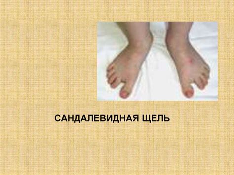 Хромосомные болезни - online presentation
