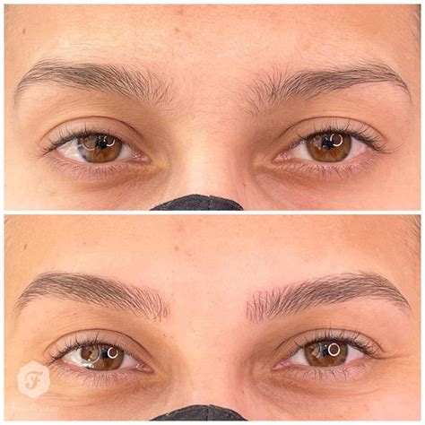 Antes E Depois Da Sobrancelha - A Real Diferença do Antes e Depois da Micro nas Sobrancelhas - Fran ...
