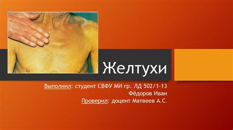 Желтухи и их виды - презентация онлайн