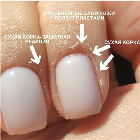 Когда кутикула стабильно отодвигается, то капилляры,нервные окончания ...