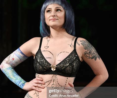 5 Life-Changing Strategies to Help Manage Lymphedema and Regain Your