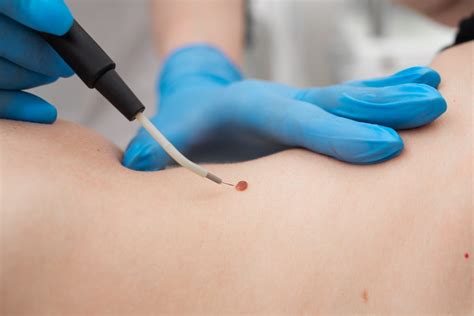 Клиника косметологии в Москве MD Beauty - MD Beauty Clinic