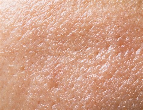 oily skin type      prequel