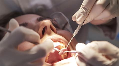 premium photo dentist performing  root canal treatment  advanced