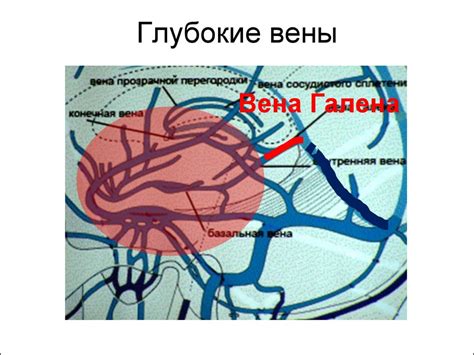 Венозный инсульт - презентация онлайн