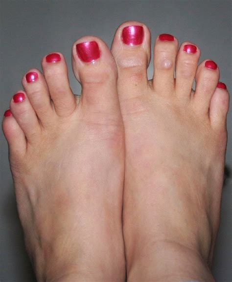 Hammer Toe Causing Knee Pain - Magan Blakey