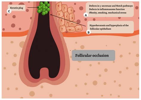 IJMS | Free Full-Text | New and Emerging Targeted Therapies for ...