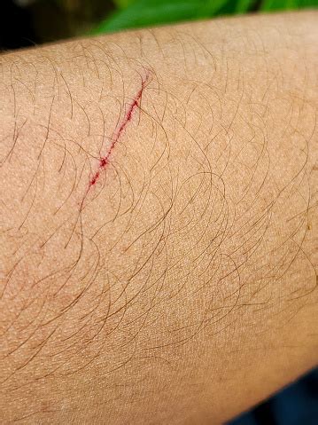 cut   arm stock photo  image  adult