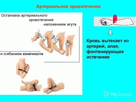 Презентация на тему: "Признаки травм рана кровотечения Боль Рана – это ...
