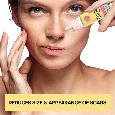 Base Labs 2-Pack Keloid & Piercing Bump Treatment Drops - 1 oz / 30ml