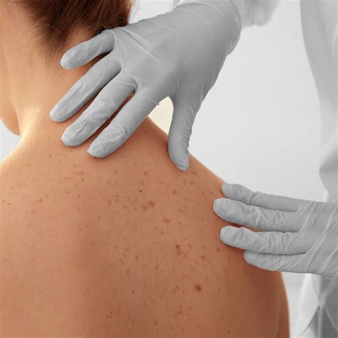 Is Bruising Easily Normal or Does It Signal a Bigger, Underlying