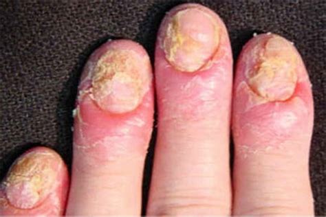 Uñas Maltratadas | Tips de Belleza Para Mujeres CANAL EN VIVO
