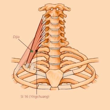 Acupuncture For Neck Pain