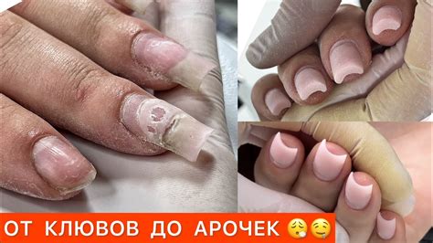 СТАЛЕКС ПИЛОЧКИ💥ОТСЛОЙКИ ПО БОКАМ И ОТ КУТИКУЛЫ С ГЕЛЕМ🧐 - YouTube