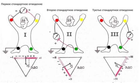 Технология проведения электрокардиографии — Студопедия