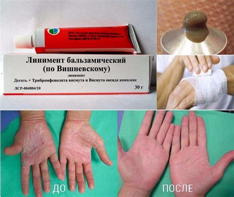 Забытые свойства целебной мази Вишневского - ВОТ ТАК ТАК