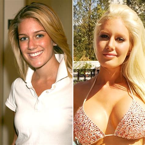 Forum Phun Celebrity Extra: Before & After Photos You Have To See Image 12