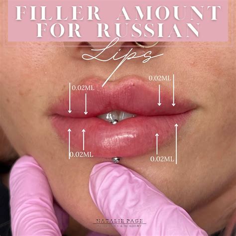 Lip filler journey – Artofit