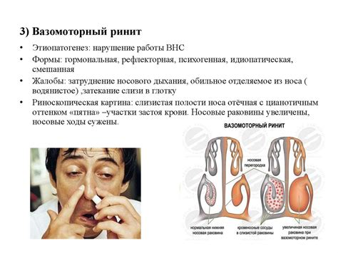 Лечебно-диагностические вмешательства и сестринский уход при ...