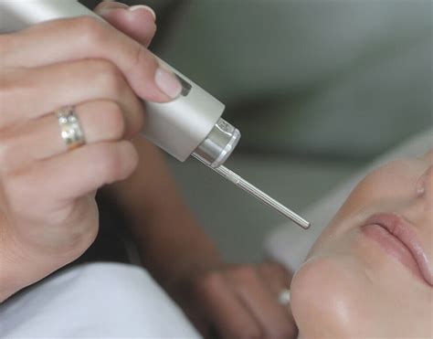 Why do they call the Fotona 4D treatment non-surgical facelift?