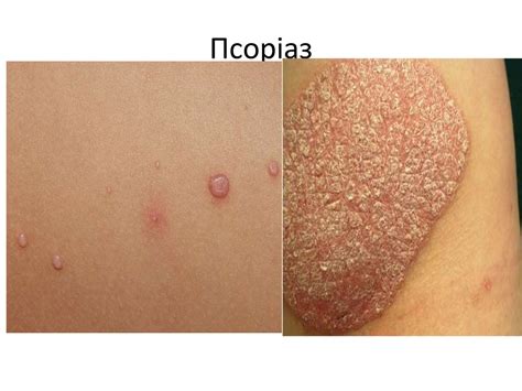 Дерматологія. Анатомія і фізіологія - презентация онлайн