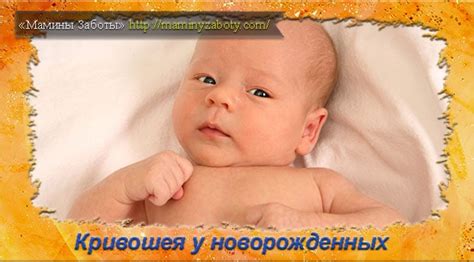 Кривошея у новорожденных - признаки и фото