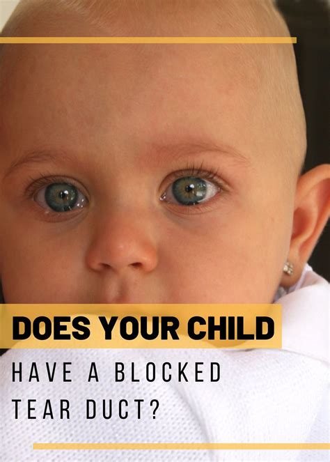 Corte de pelo halcón charla signs of blocked tear duct tienda reinado