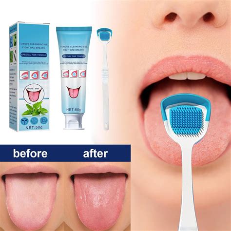 grgowe white hairy tongue removal kit effective tongue cleaner set