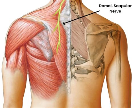 Dorsal Scapular Nerve Entrapment: Causes, Symptoms & Soft Tissue