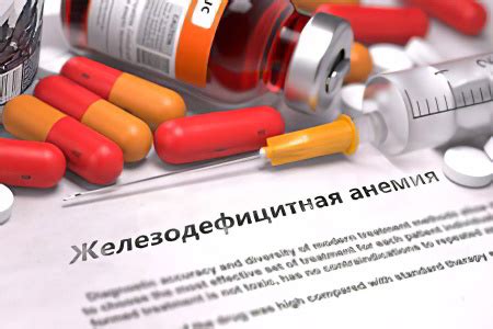 Препараты железа при лечении анемии – список препаратов